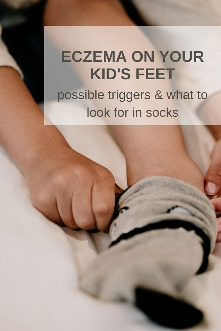 socks for eczema 1