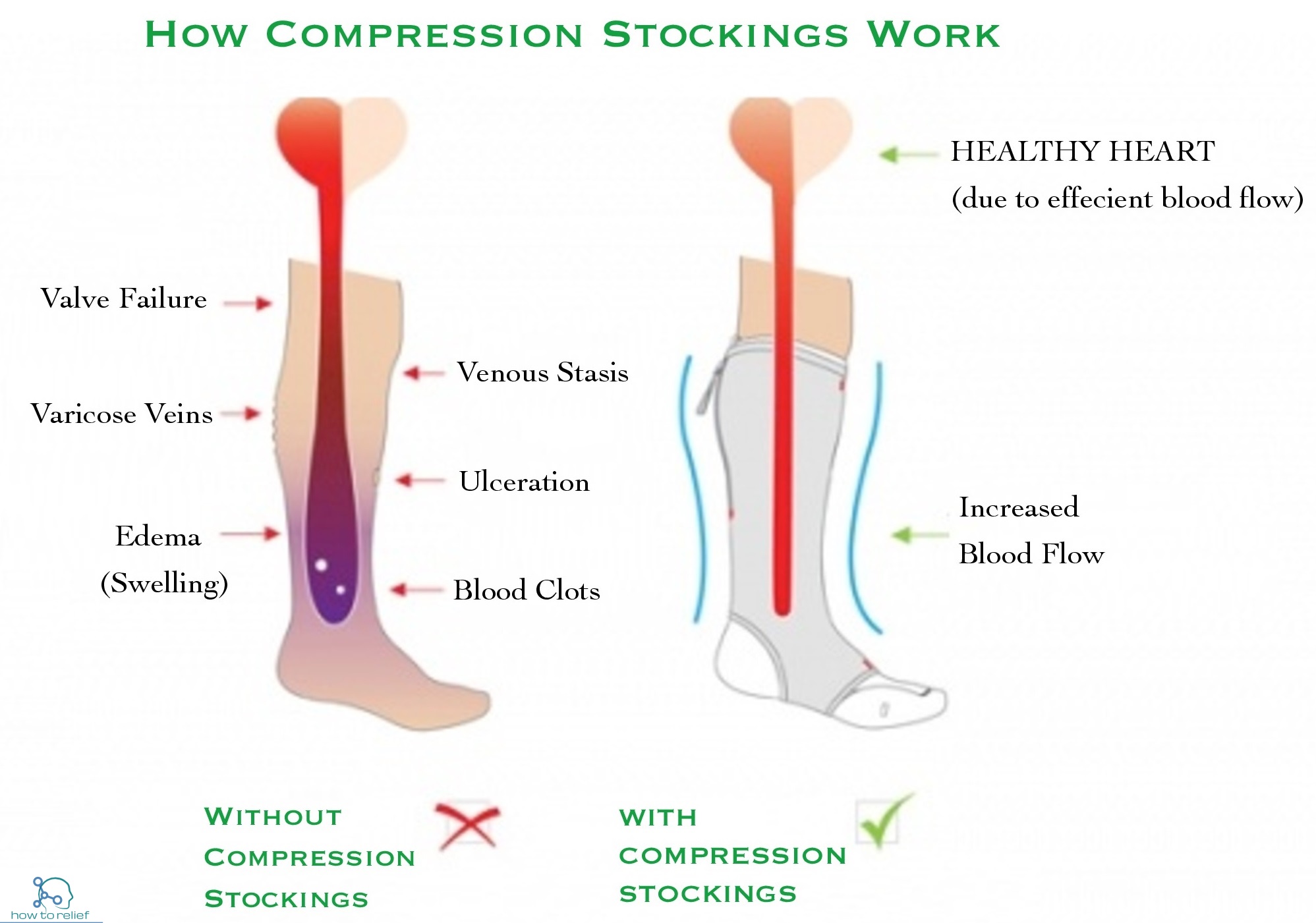 type of compression socks 2