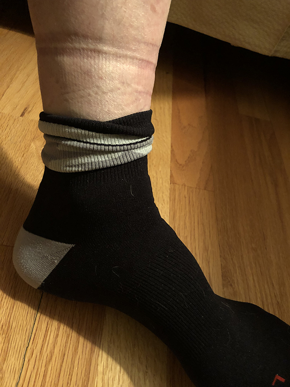 socks that don't leave marks 2