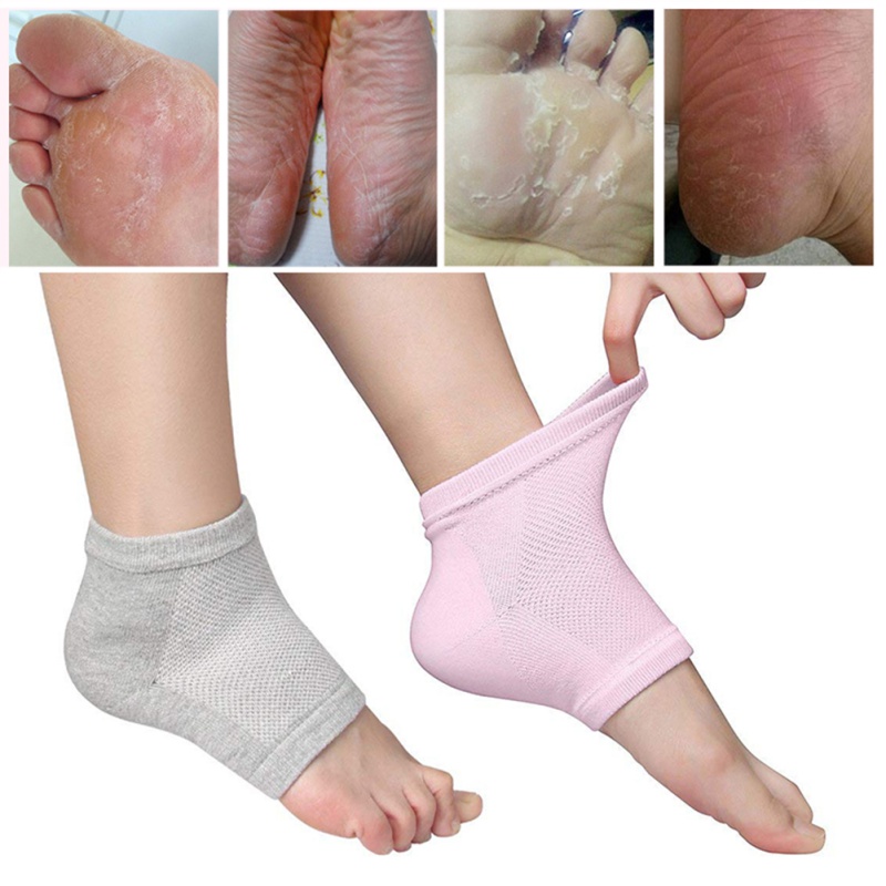 socks for dry cracked feet 1