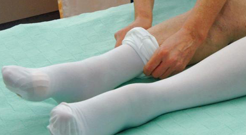 compression socks after surgery 2